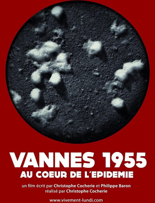 Vannes 1955, au cœur de l’épidémie